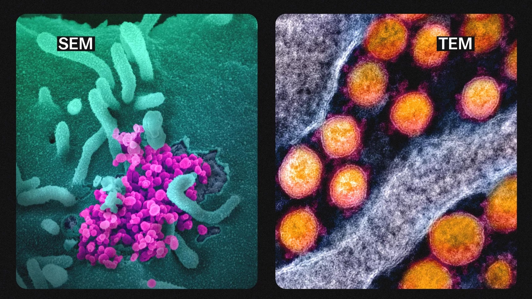 lam sao chup duoc virus SARS-CoV-2 anh 8