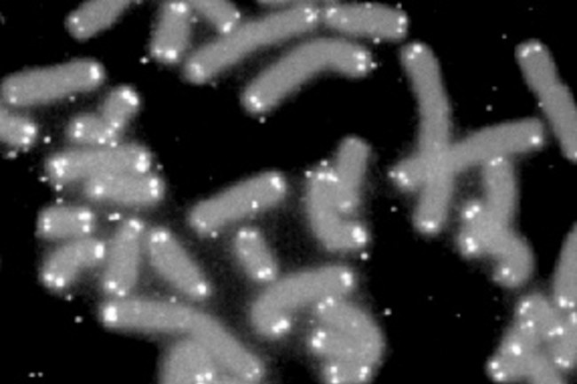 co the hoi sinh nguoi chet khong anh 5