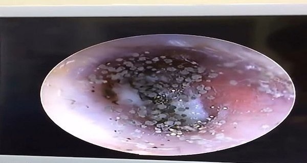 Moc nam o tai vi deo headphone qua nhieu hinh anh