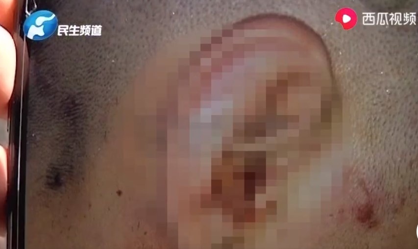 airpods phat no tren tai nguoi dung anh 2