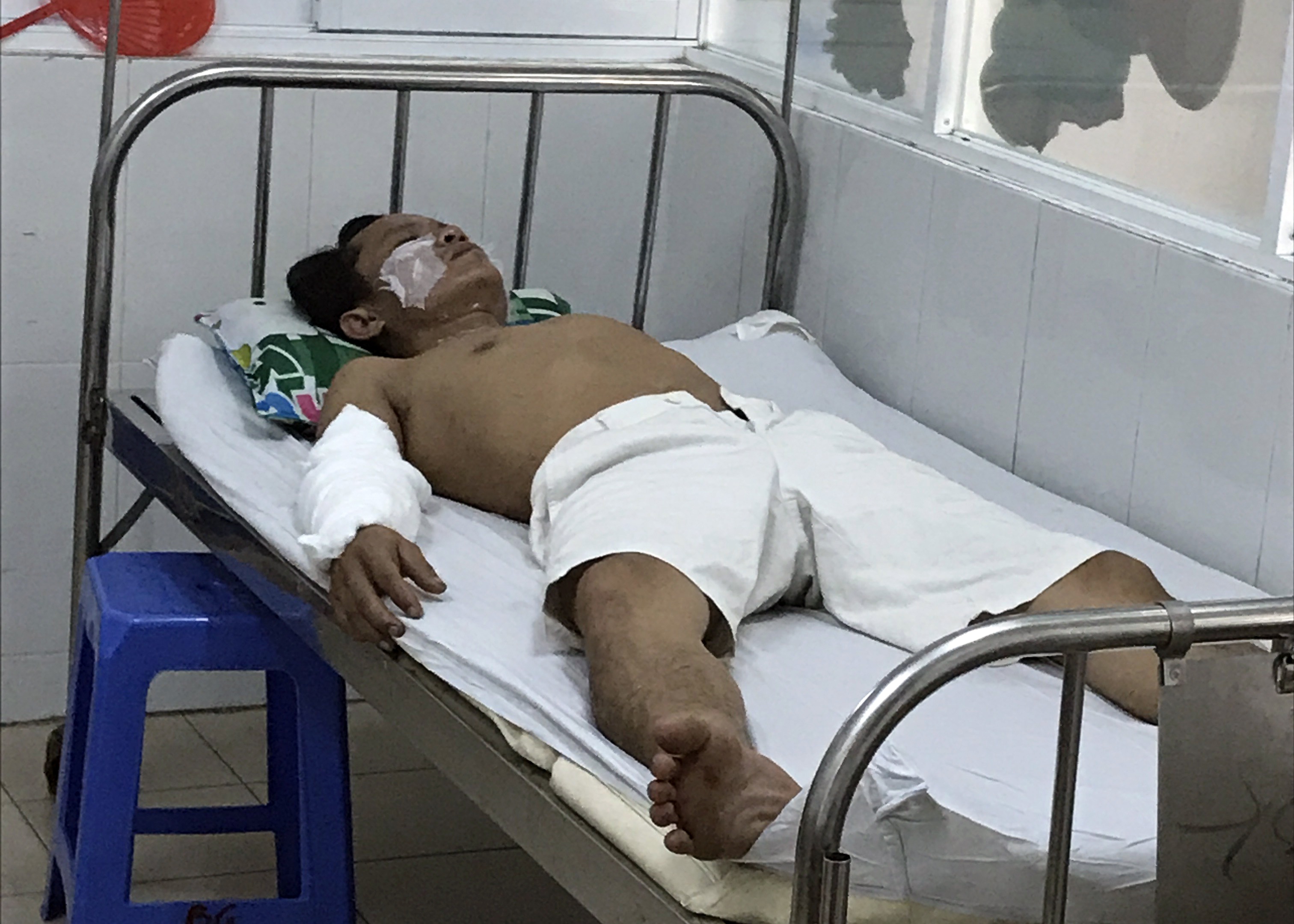 No thiet bi nen gach men, 4 cong nhan bi bong hinh anh