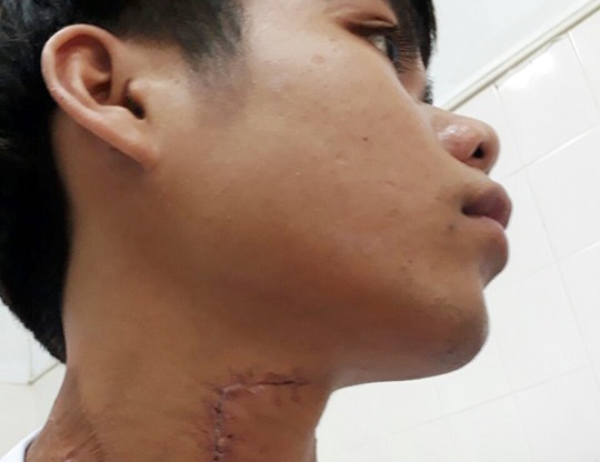 Nam thanh nien bi trau huc thung khi quan khi dang choi dua hinh anh