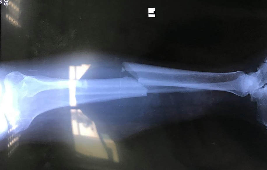 Tai nan tren cao toc Da Nang - Quang Ngai, 2 nguoi bi thuong hinh anh