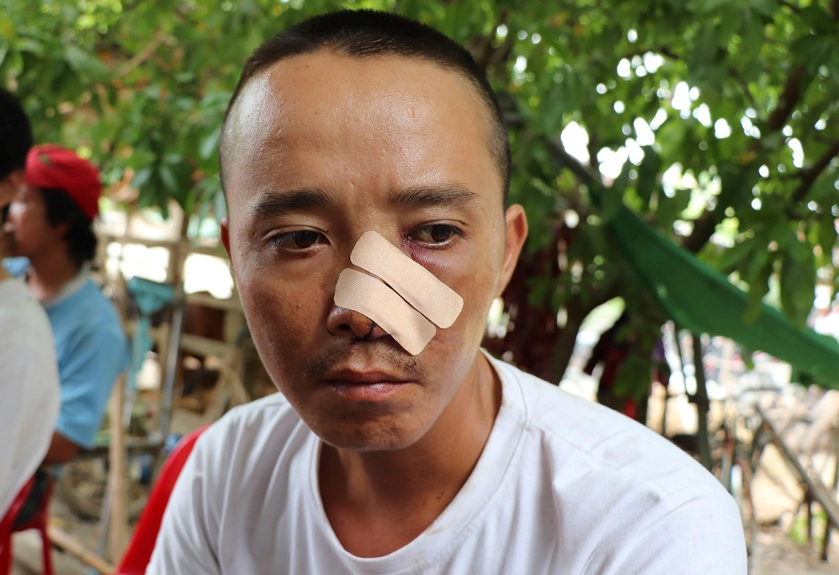 Phut 20 ke la mat truy sat 3 cha con o Quang Nam hinh anh