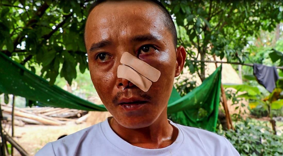 Nan nhan vu 3 cha con bi chem: '20 nguoi cam dao, kiem xong vao nha' hinh anh