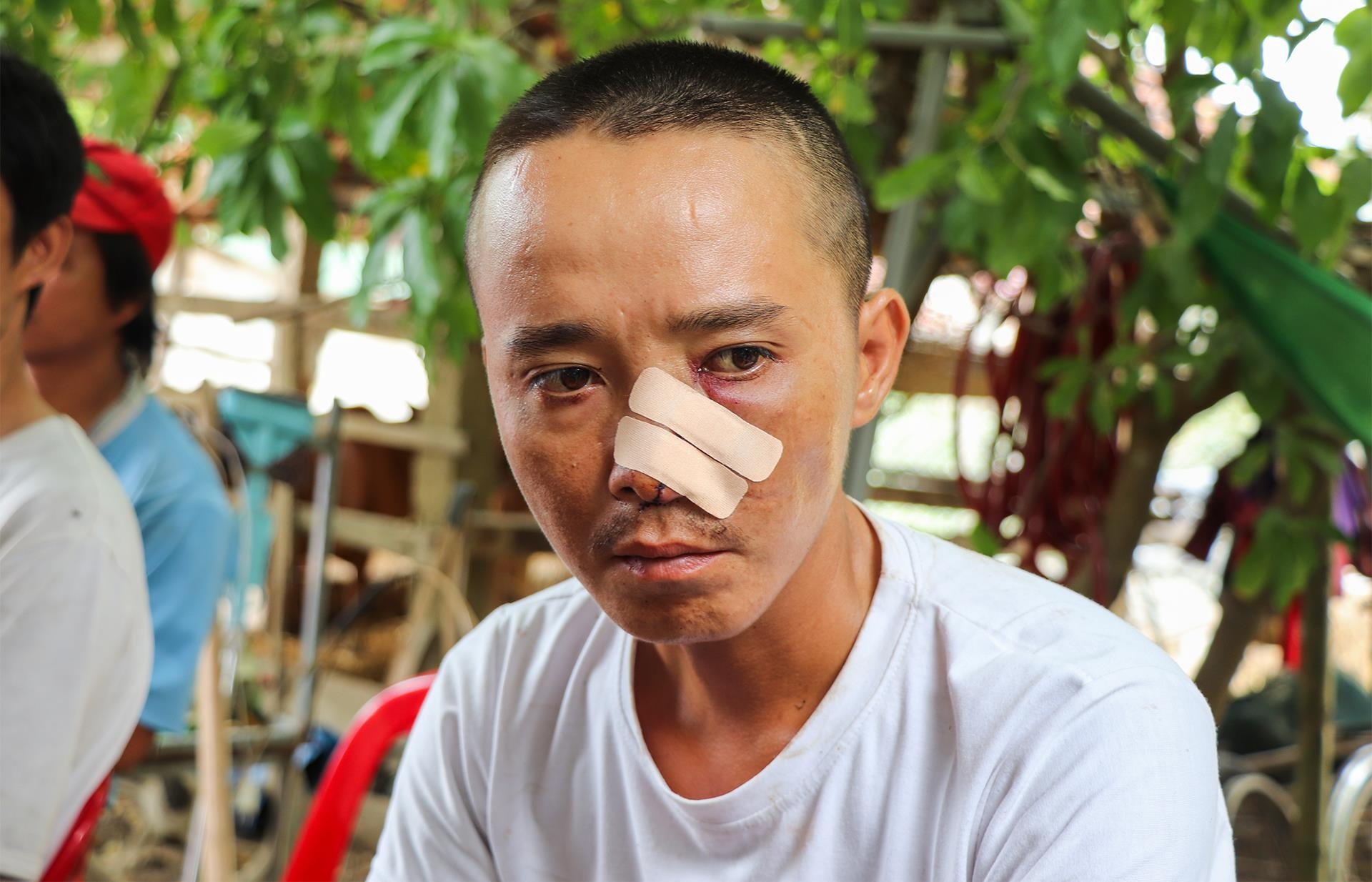 Truy sat 3 cha con anh 2