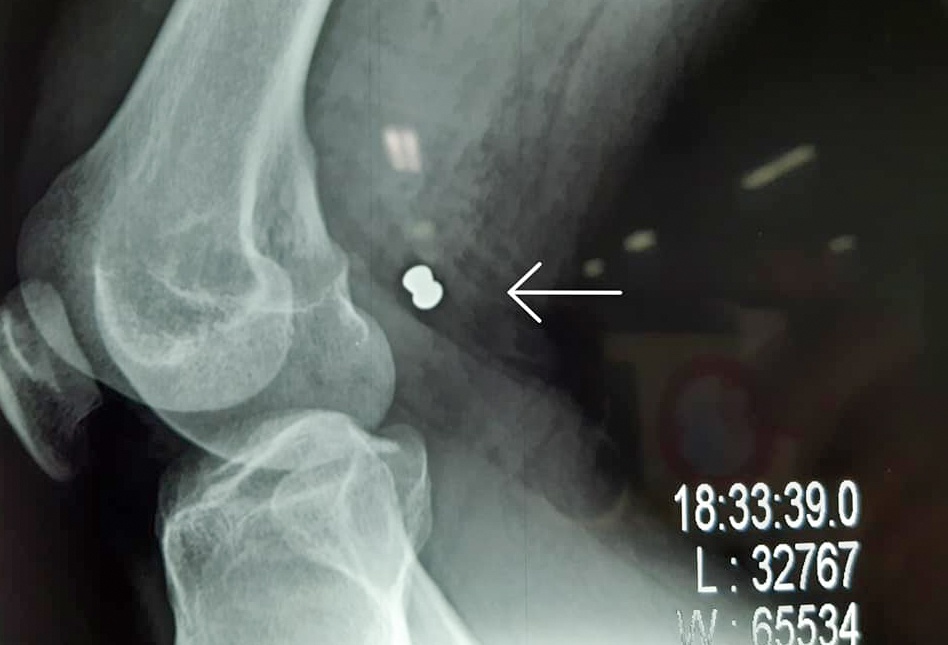 Cuu nguoi dan ong bi trung dan hinh anh