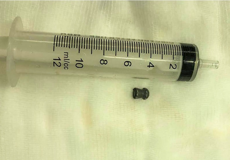 dan lac trung dui nguoi dan anh 1