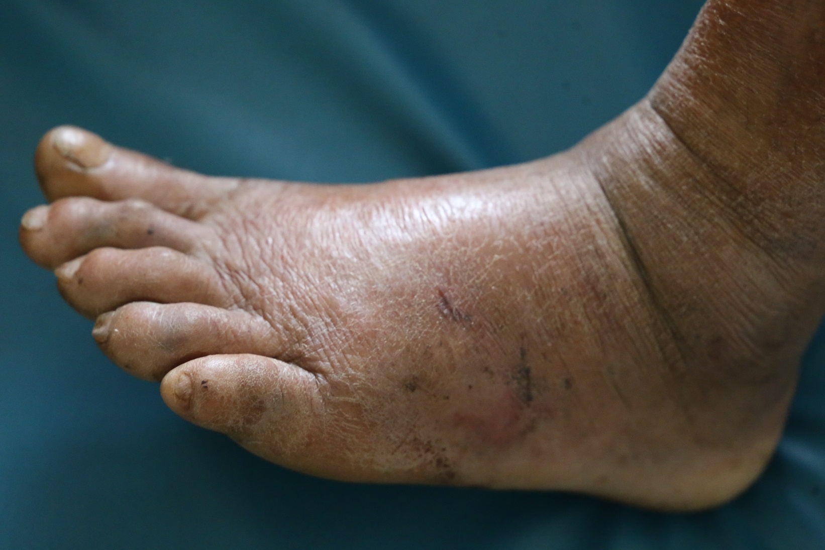 cu ong 92 tuoi bi ran can anh 1