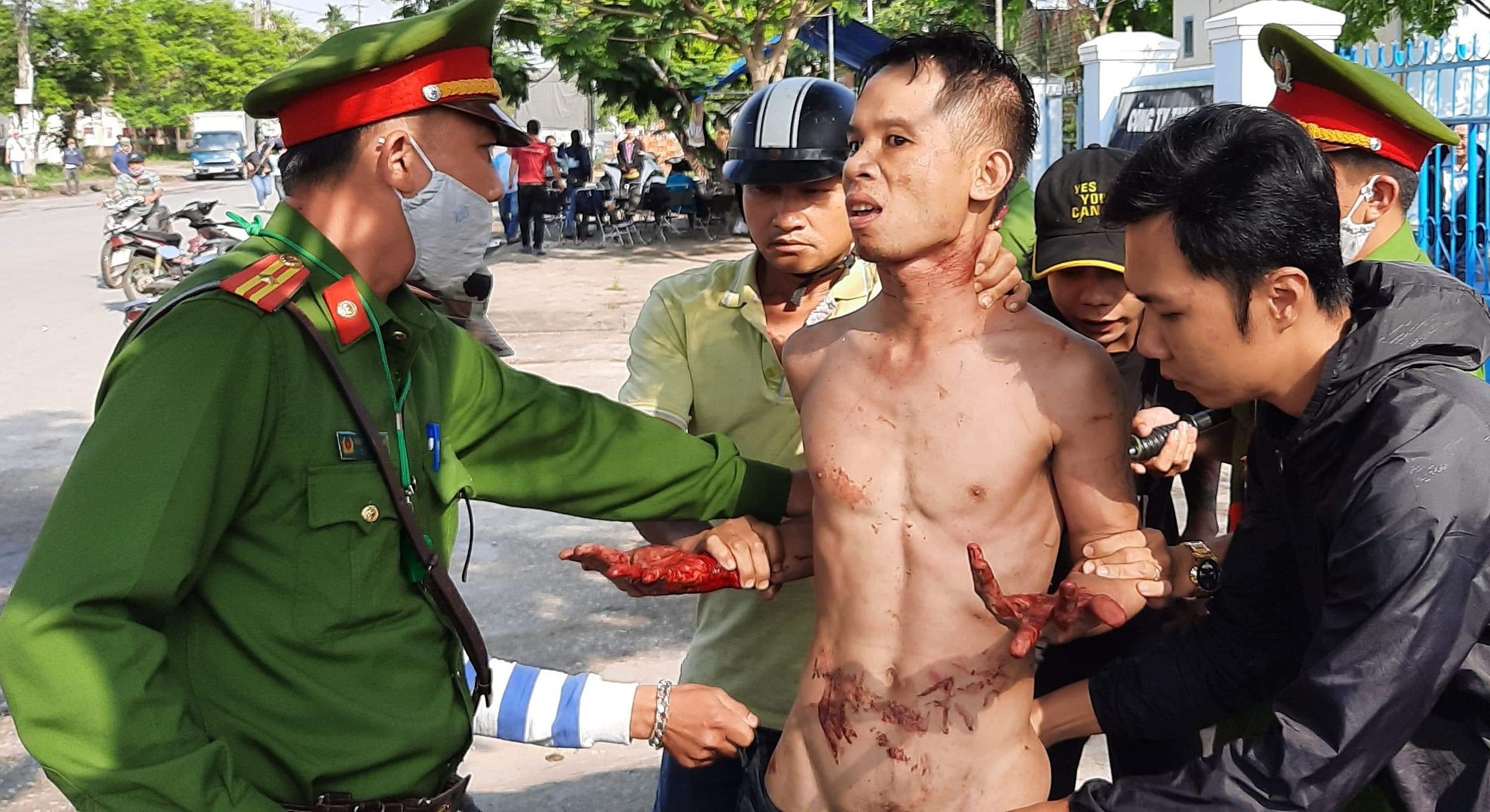 Thanh nien ngao da tu gay thuong tich hinh anh