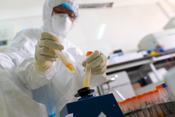 So Y te Quang Nam tung muon 3 may xet nghiem cua Cong ty Viet A hinh anh