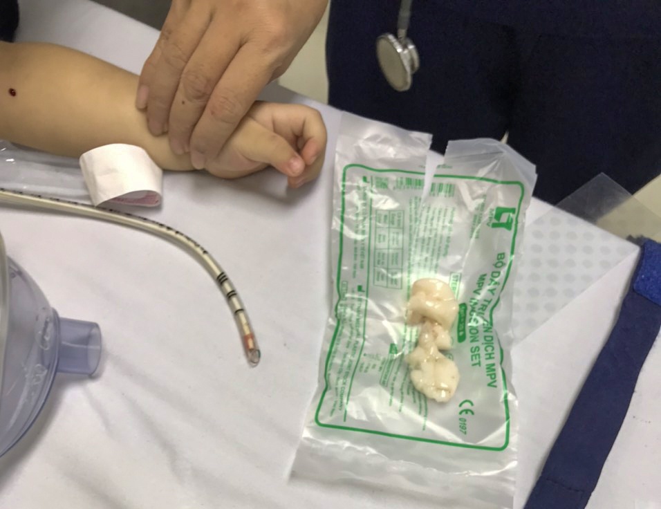 tre hoc thach rau cau anh 1