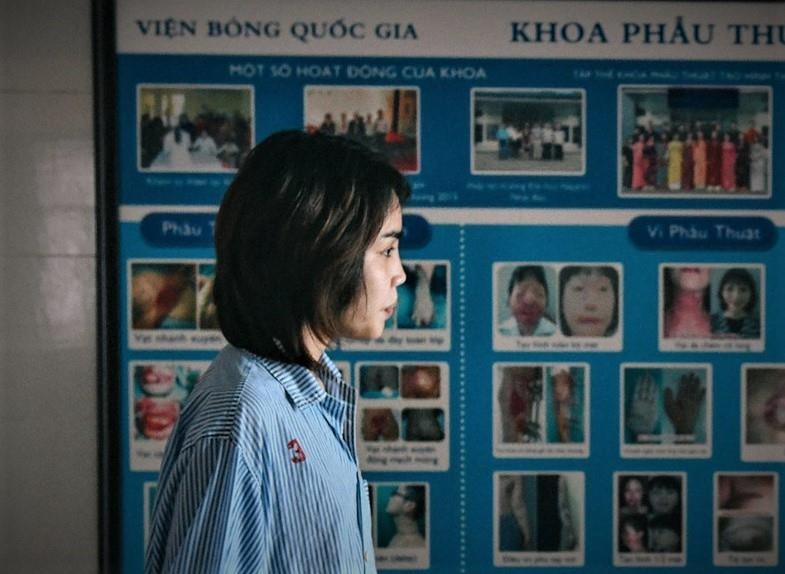 Thieu uy cong an tat axit vao mat vo sap cuoi. anh 2