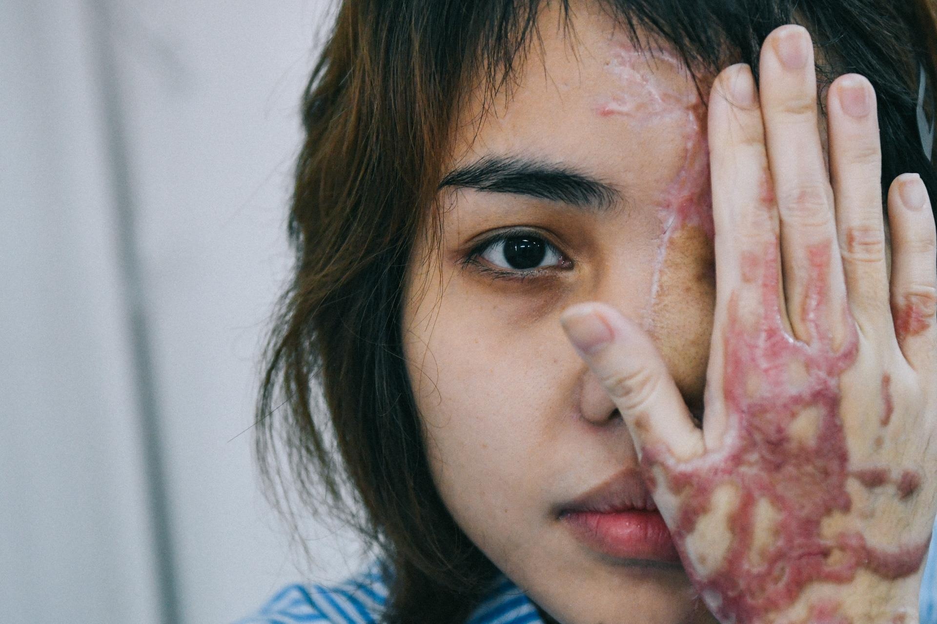 Nguoi ban axit cho cuu thieu uy cong an: 'Toi rat soc' hinh anh