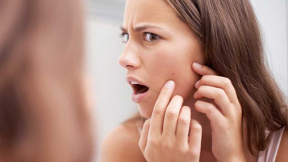 phân biệt da dị ứng và đẩy mụn ảnh 3 phan biet da di ung va day mun anh 3