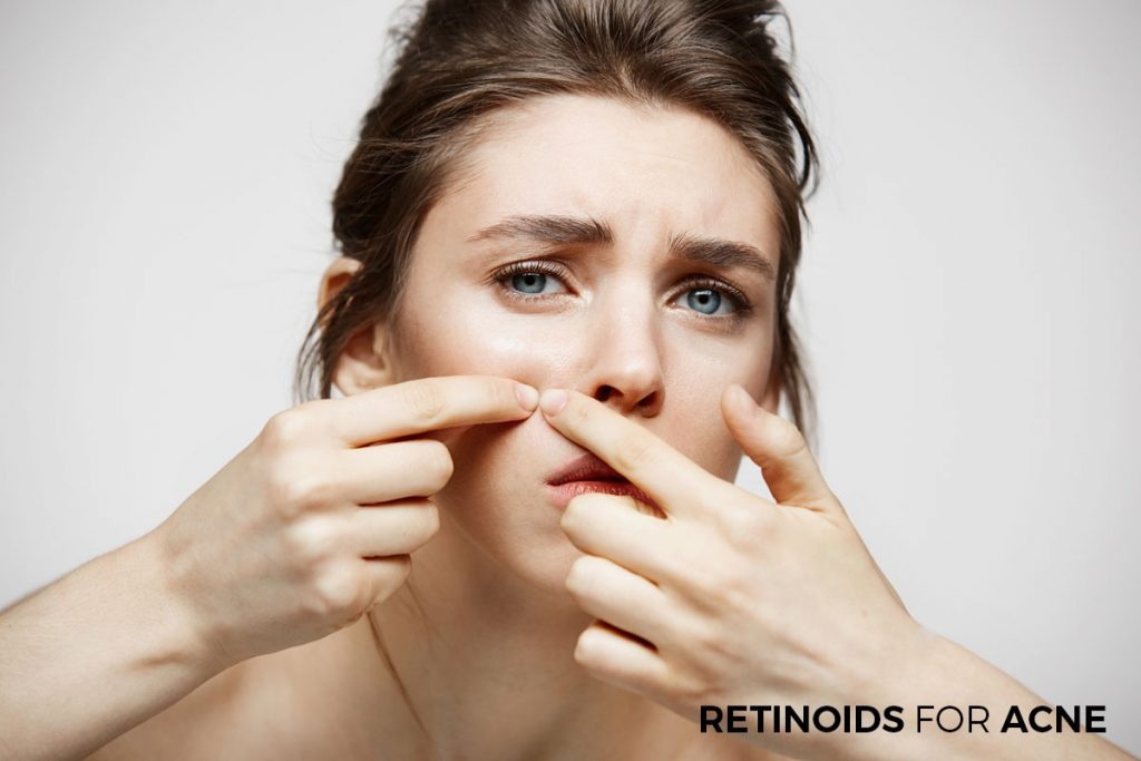trị mụn retinoids ảnh 5 tri mun retinoids anh 5