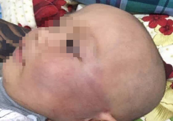 Danh sung ma tre 19 thang tuoi, bao mau noi doi be nga cau thang hinh anh