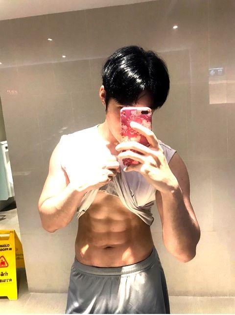 phau thuat bung 6 mui anh 15