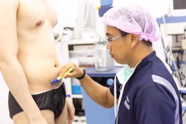 phau thuat bung 6 mui anh 3