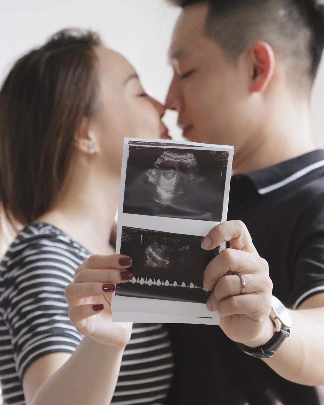 beauty blogger Trinh Phạm khoe sắp làm mẹ ảnh 1 beauty blogger Trinh Pham khoe sap lam me anh 1