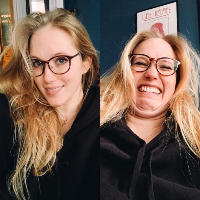 bo anh truoc va sau khi lam xau cua phu nu anh 4