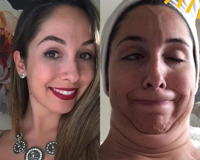 bo anh truoc va sau khi lam xau cua phu nu anh 6