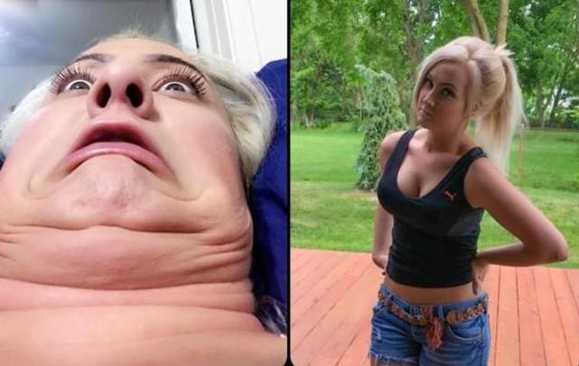 bo anh truoc va sau khi lam xau cua phu nu anh 7