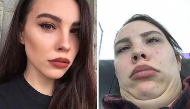 bo anh truoc va sau khi lam xau cua phu nu anh 1