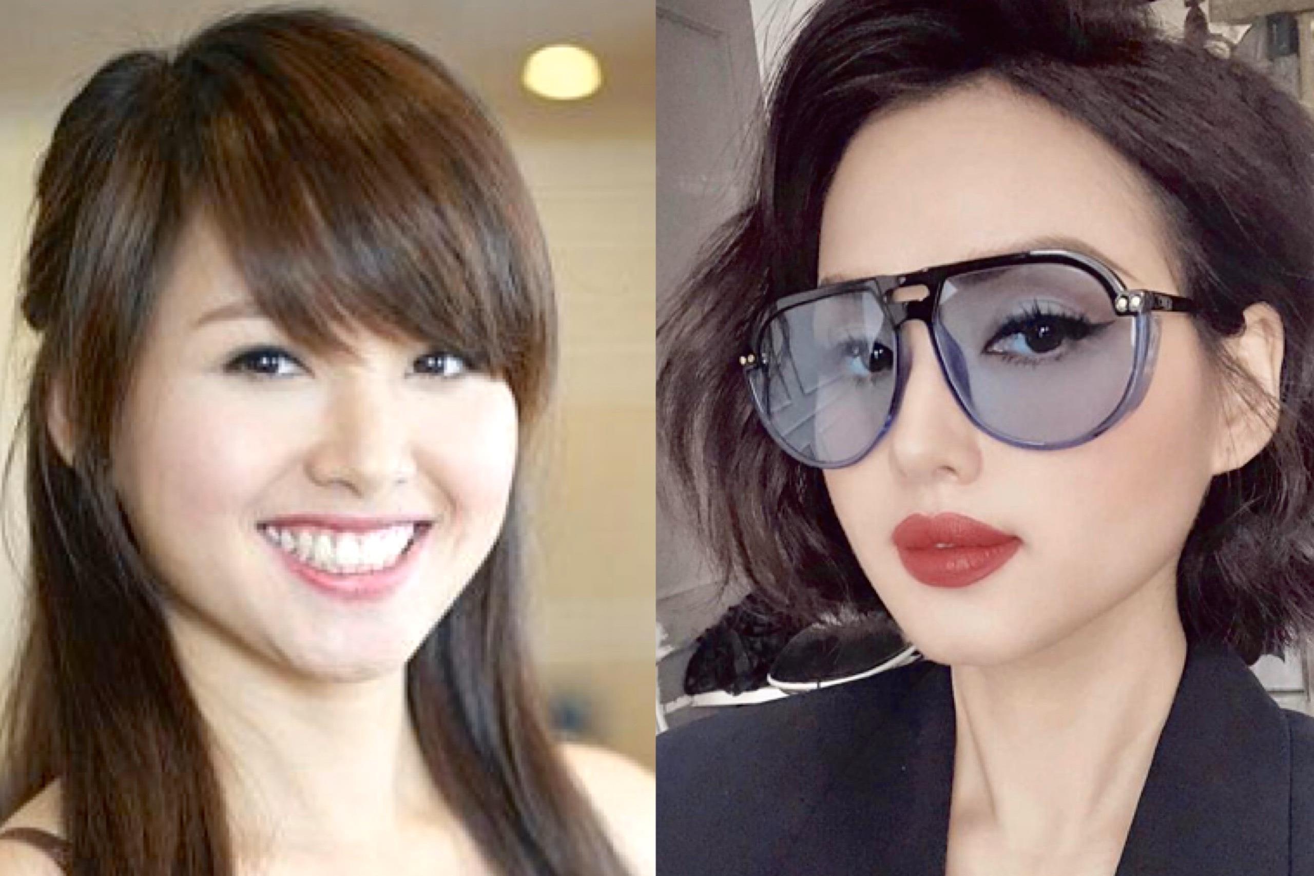 Tam Tit khang dinh dep tu nhien, khong phau thuat tham my hinh anh