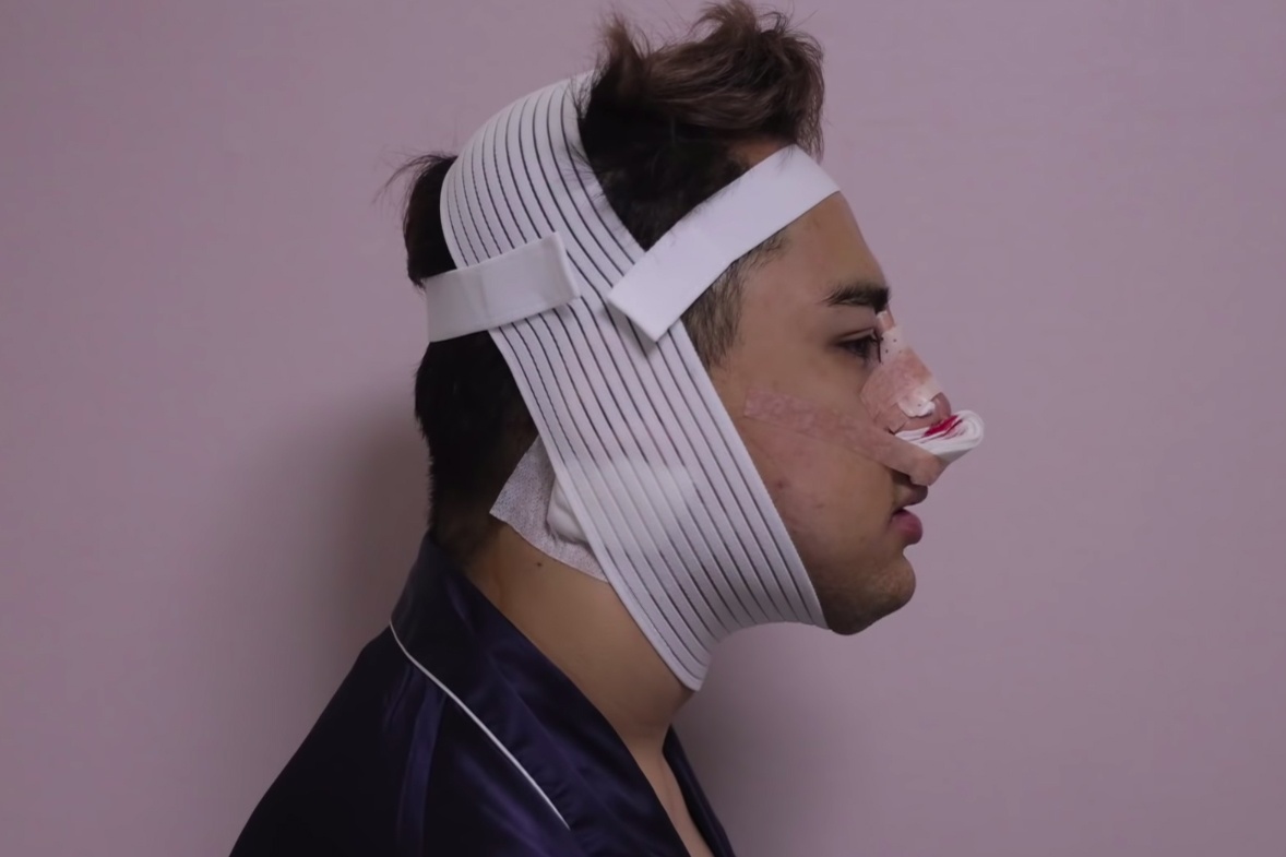 Phau thuat tham my anh 7