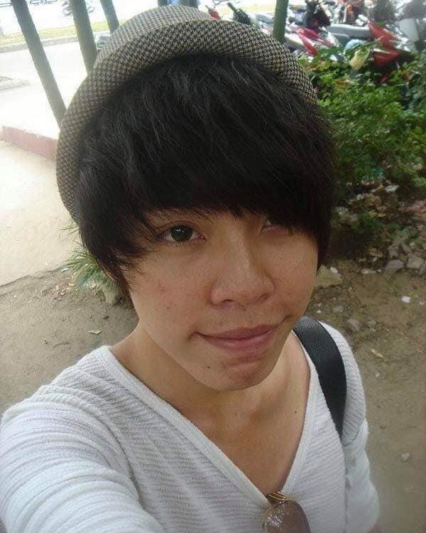 Phau thuat tham my anh 2