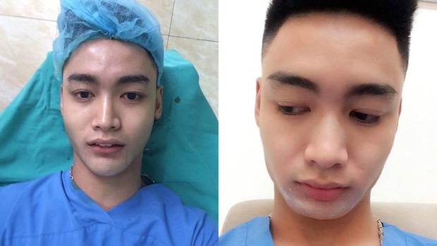 Phau thuat tham my anh 10