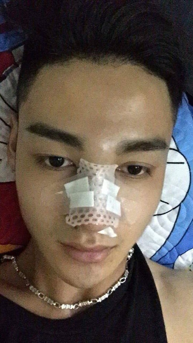 Phau thuat tham my anh 11