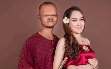 Tinh yeu cua 3 doi dua lech noi tieng voi dan mang hinh anh