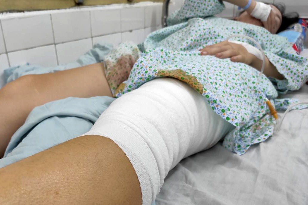 nữ cổ động viên bị pháo sáng ném vào chân ảnh 1 nu co dong vien bi phao sang nem vao chan anh 1