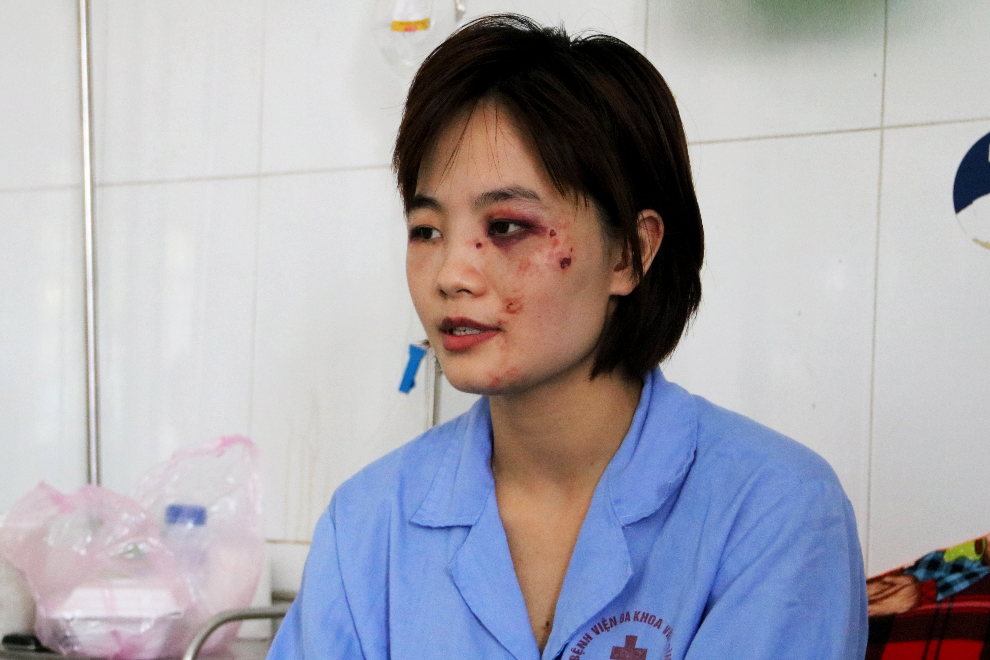 nu phu xe bi hanh hung tren xe bus anh 1