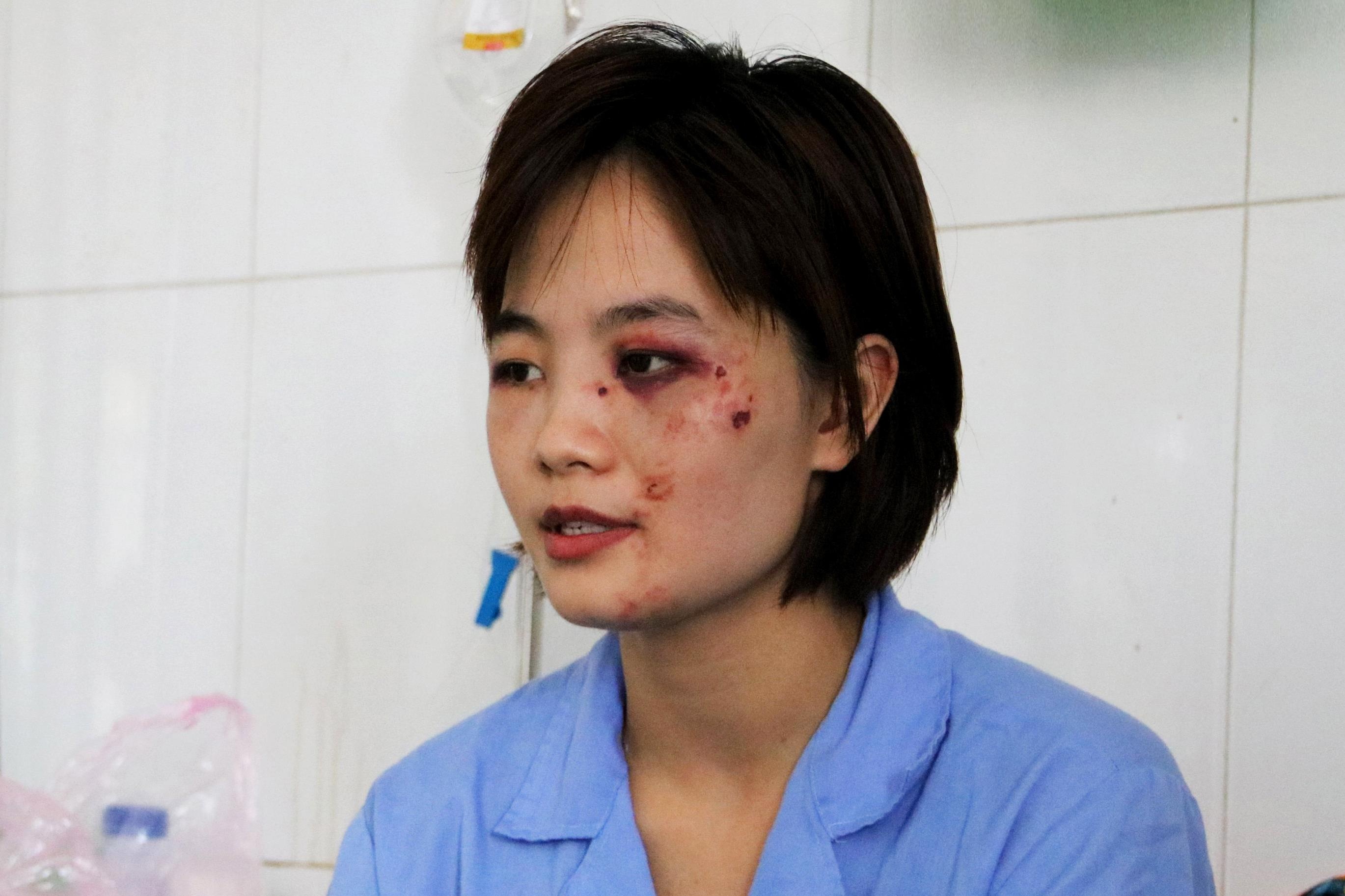 Nu phu xe bi 5 thanh nien danh nhap vien: ‘Toi tui than va am anh’ hinh anh