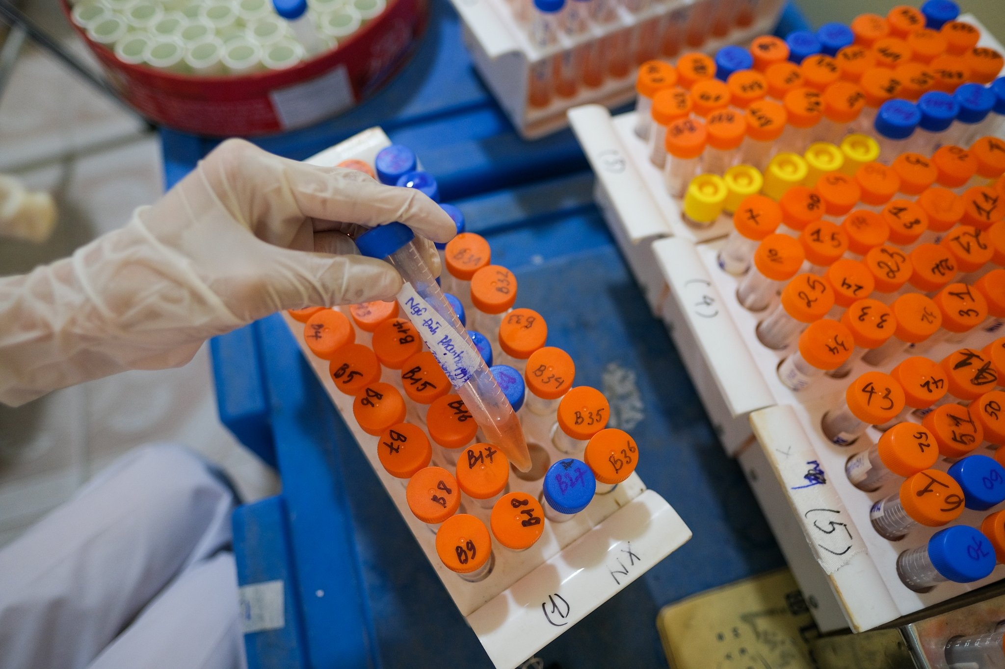 ca mac Covid-19 o Bac Giang anh 1