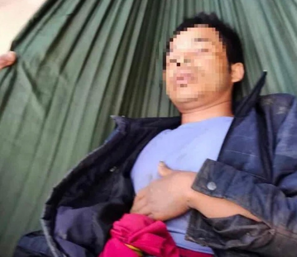 Nam thanh nien o Quang Tri bi trau huc thung bung hinh anh