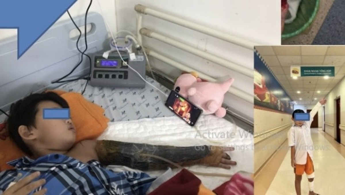 Be trai bi dap nat tay vi ket vao may tron be tong hinh anh