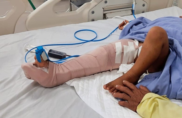 Oto cho khach di chua gay tai nan khi xuong doc, 2 nguoi thuong vong hinh anh