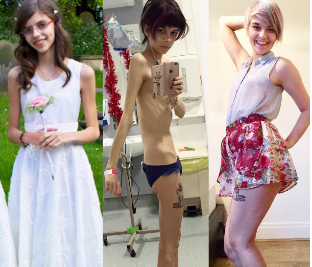 Nhung nguoi phu nu tro nen xinh dep hon sau khi tu bo viec an kieng anh 8