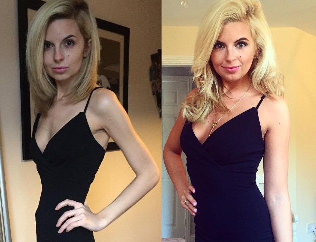 Nhung co gai tro nen xinh dep sau khi tu bo viec an kieng hinh anh