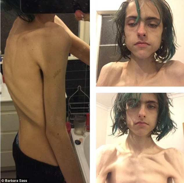 Co be mac benh khien ca doi phai an bang ong thong hinh anh