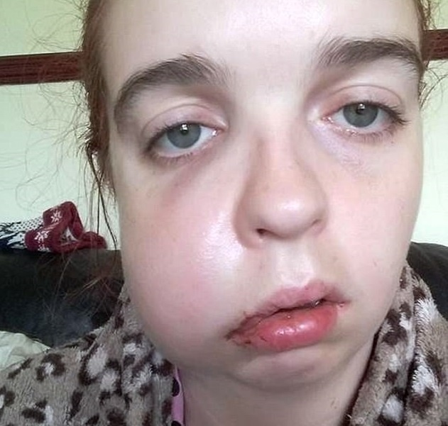 Mat bien dang vi mac benh hiem gap hinh anh