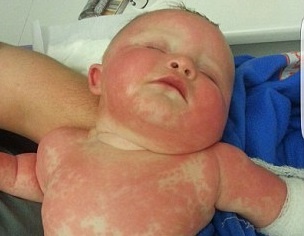 Nguoi me cuu song con gai nho ban nang mach bao hinh anh