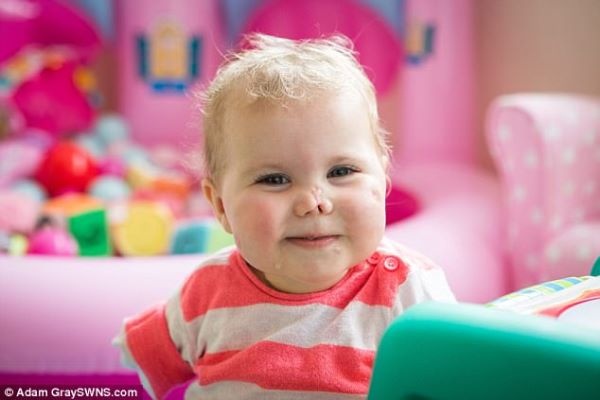 Nhung buoc di dau tien cua be gai mat chan tay do viem mang nao hinh anh