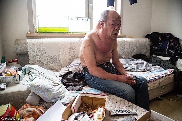 Nguoi dan ong co chiec co voi vi mang khoi u khong lo hinh anh