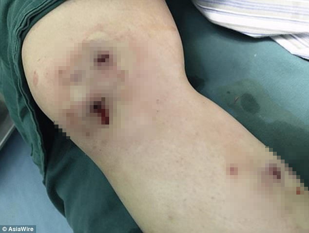 Gioi lam to trong chan vi con trung can sau khi du lich trong rung hinh anh