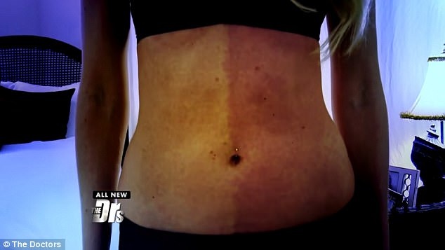 Hien tuong hiem trong y hoc: Hai co the trong cung mot nguoi hinh anh